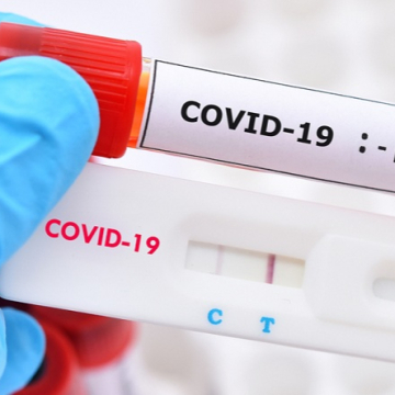 Над 500 нови случая на коронавирус у нас