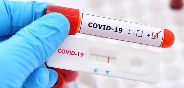 Близо 3000 нови случая на COVID-19 у нас и 99 починали