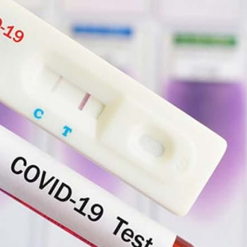 Новите случаи на COVID-19 в Кюстендилска област са – 64, в  Перник –41, в Благоевград - 127