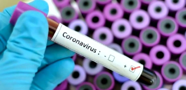 65 нови случая на коронавирус в област Кюстендил