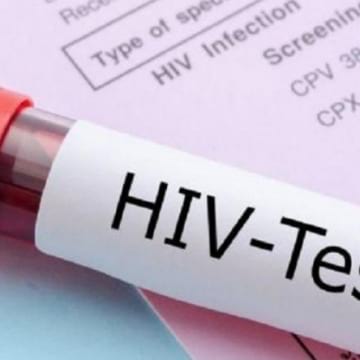 Първи случаи на СПИН и морбили в Кюстендилска област
