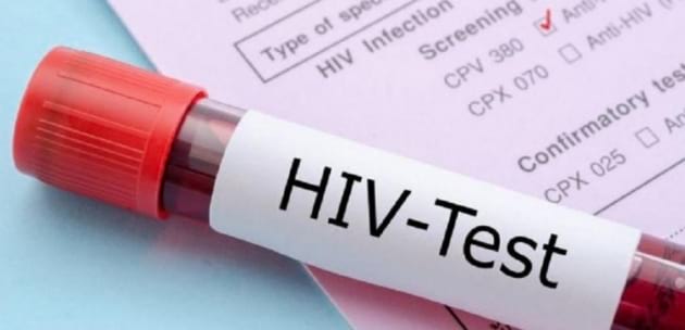 Нови случаи на СПИН, сифилис и морбили в Кюстендилска област